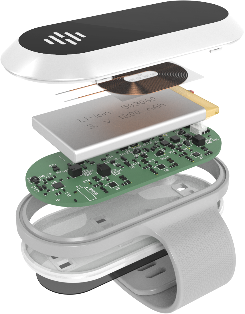 Exploded view of wristband